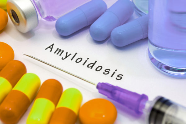 Лечение амилоидоза в Израиле